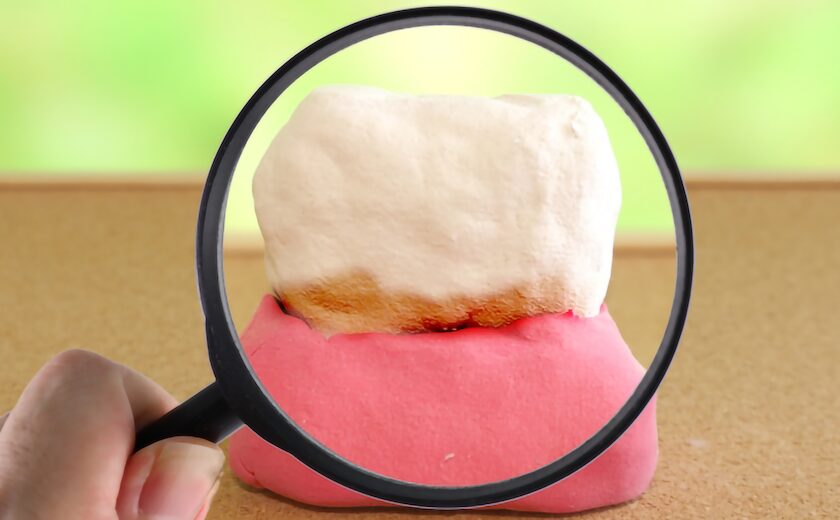 歯周病はなぜ恐ろしい？