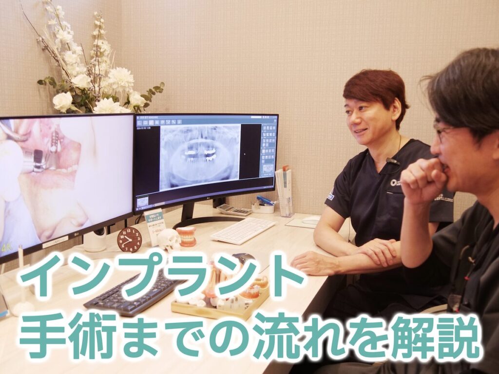 インプラント手術までの流れ